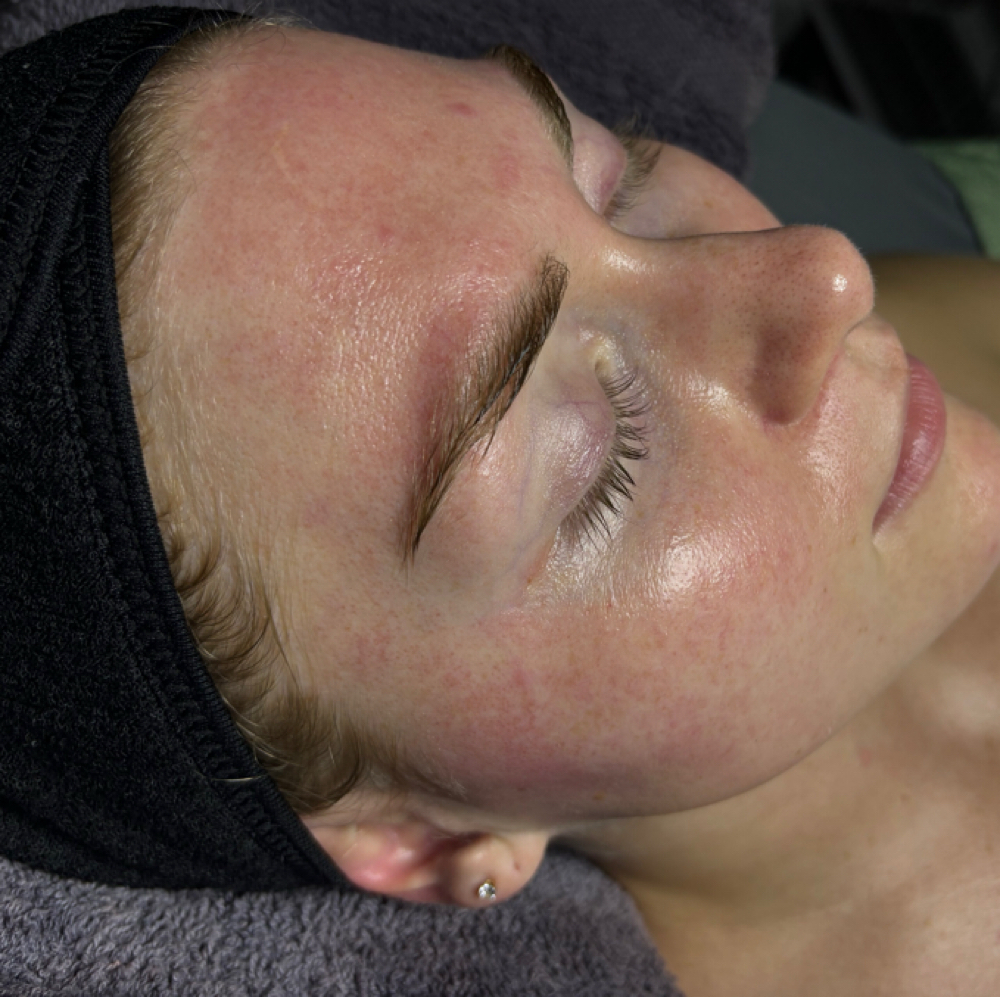 Express Glow Dermaplane at Studio P in Lexington, KY