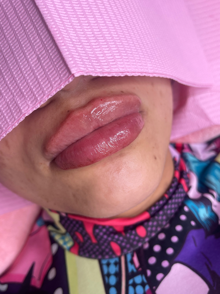 1.5ML Elasty G (March Sale