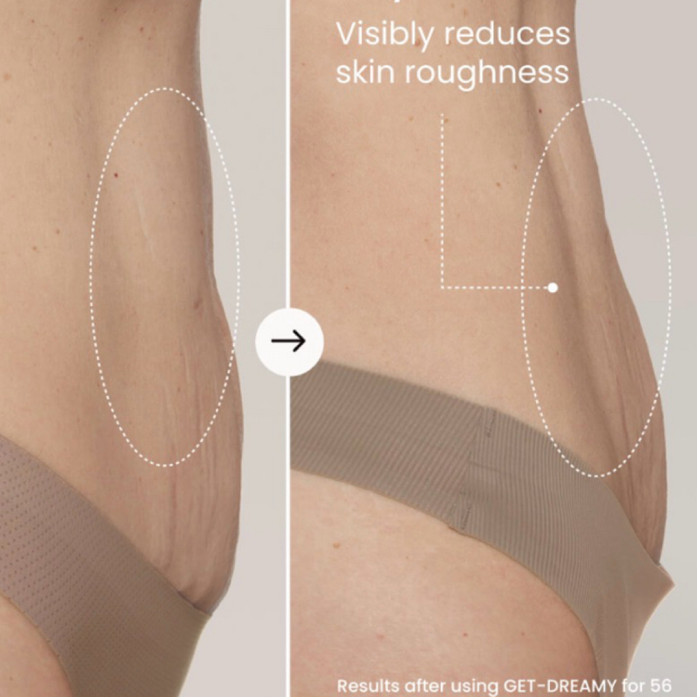 Skin Tone/Tightening Service at Finesse Wellness Solutions in Conley, GA