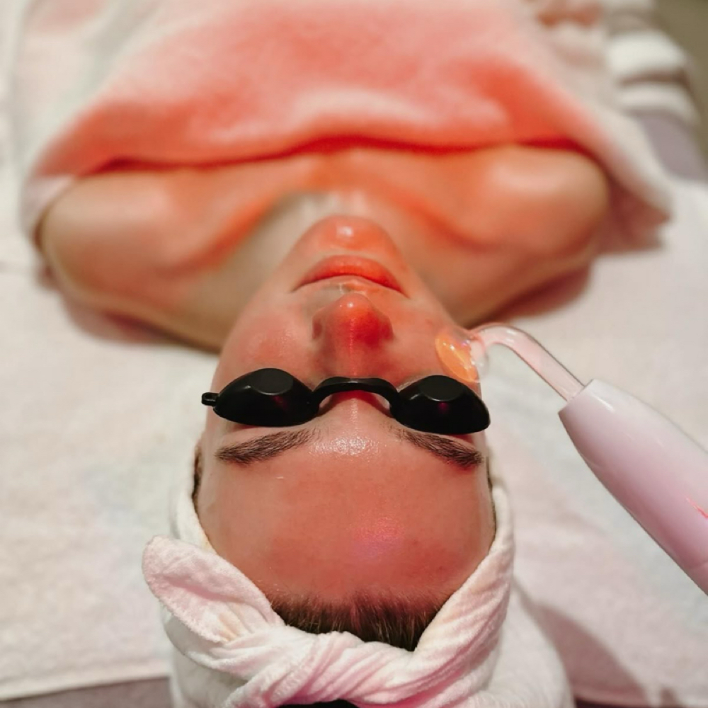 Acne Facial Treatment at Bewitching Beauty + Spa & Wax in Granite Falls, NC