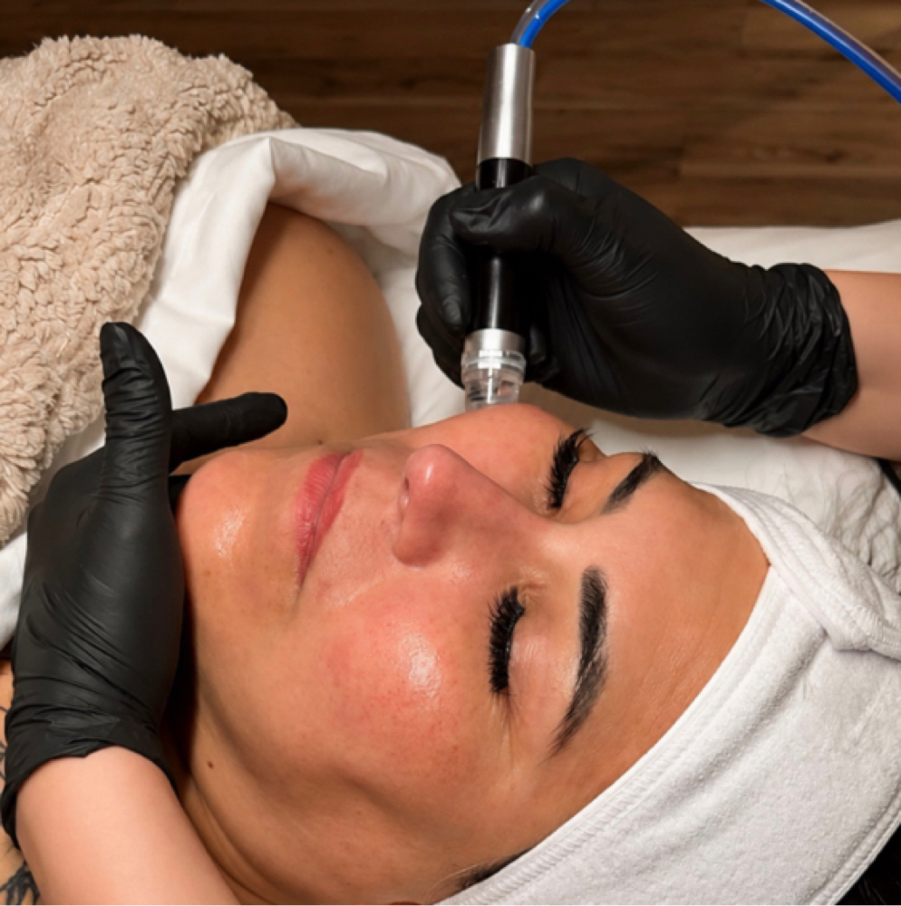 HydroFacial at LeZen Esthetics in San Antonio, TX