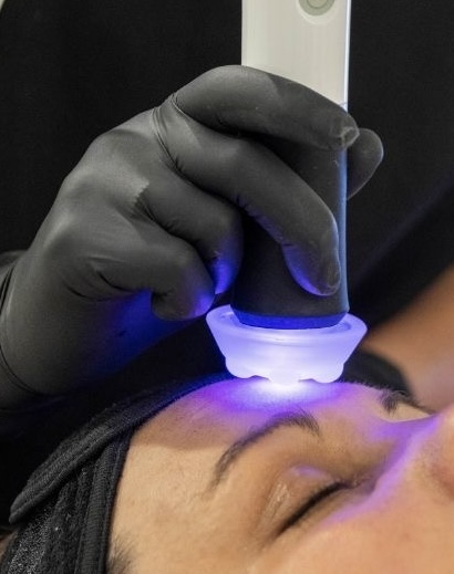 Cavitation And RF Facial