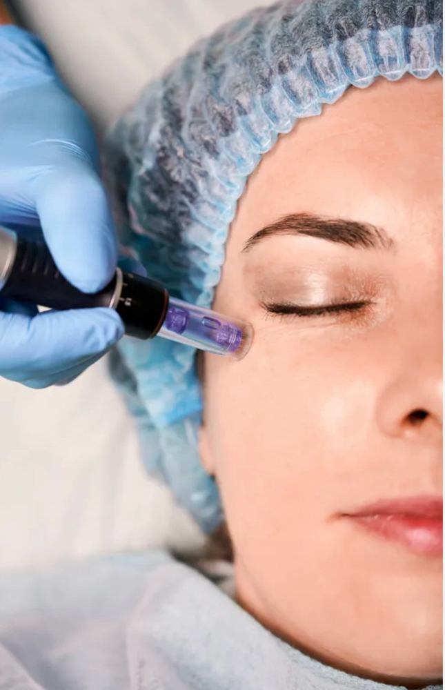 Facial micro infusion