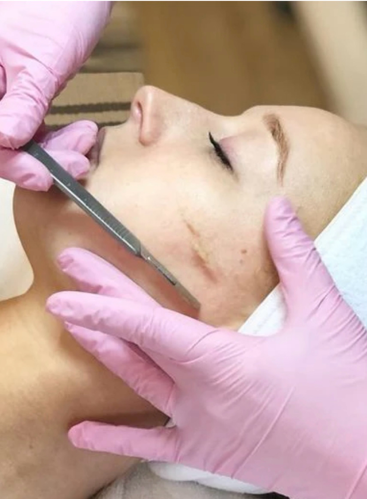 Dermaplaning