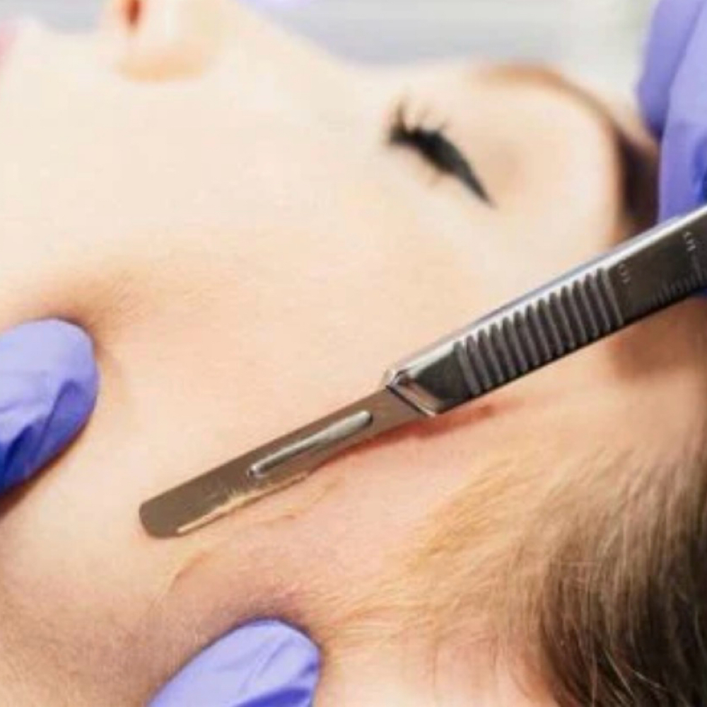 Express Glow Dermaplane Facial at Evolve Wellness and Aesthetics in Vidalia, GA