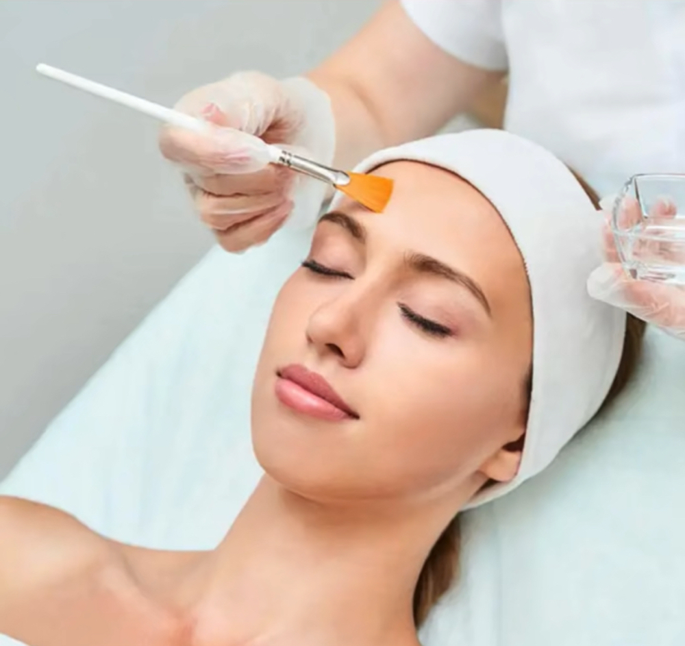 TCA Chemical Peel
