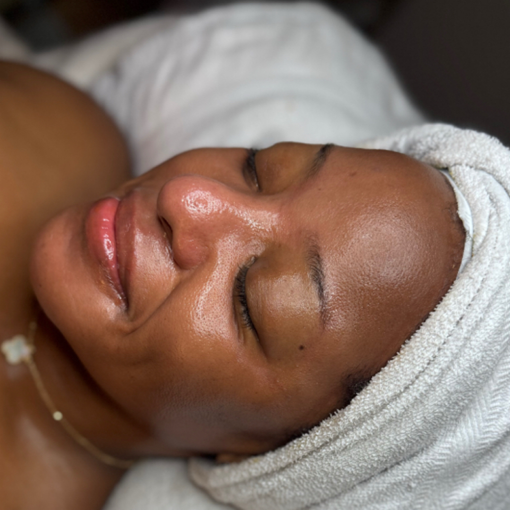 Collagen Rejuvenation at Skin Pretty Med Esthetics in Private Suite, MO