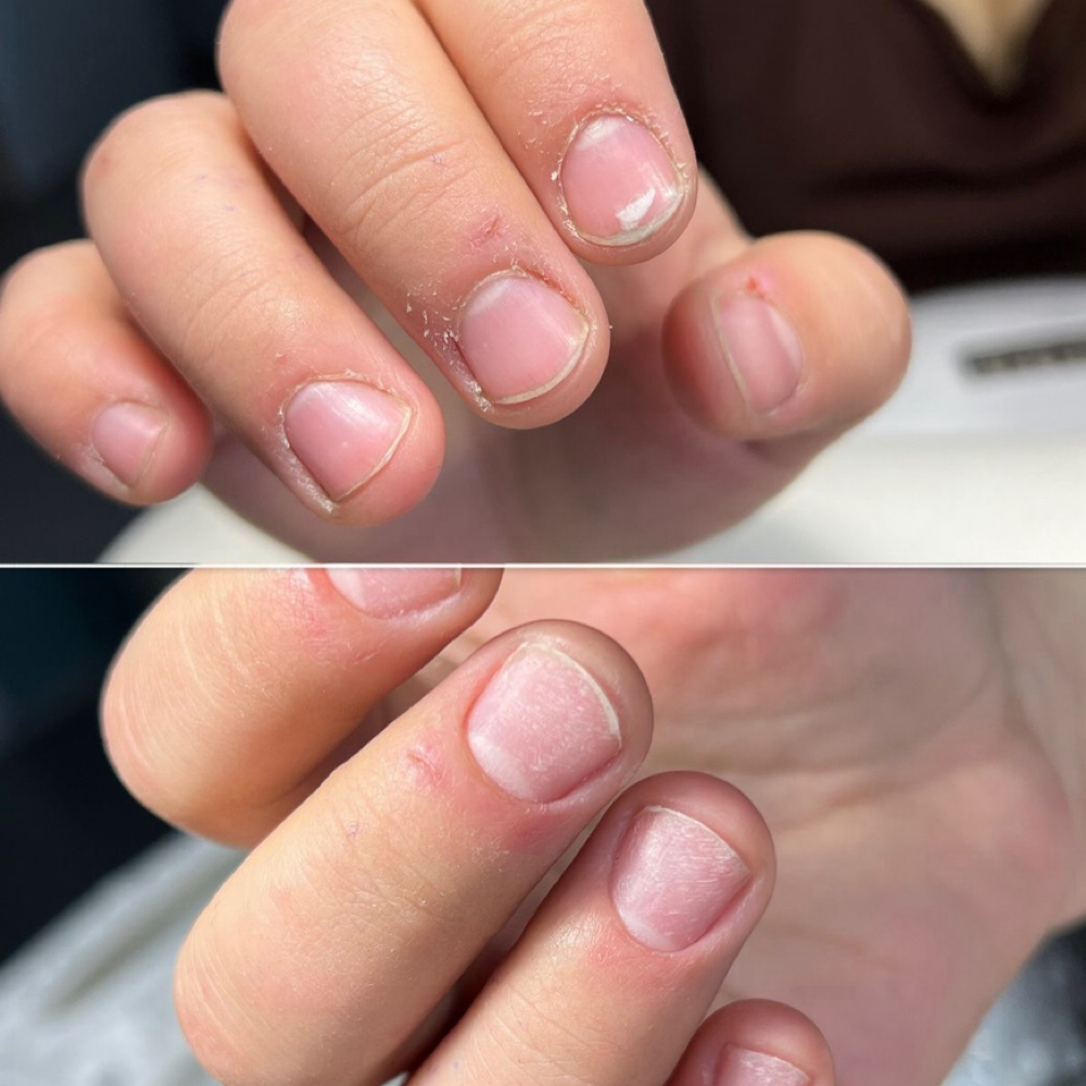 Dry Manicura Profilaxis at Dream Nails By Katterine in Corona, NY