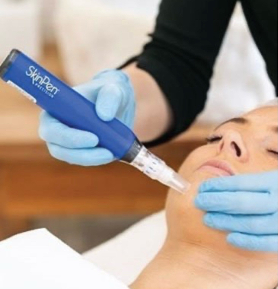Skin Pen Microneedling Treatment