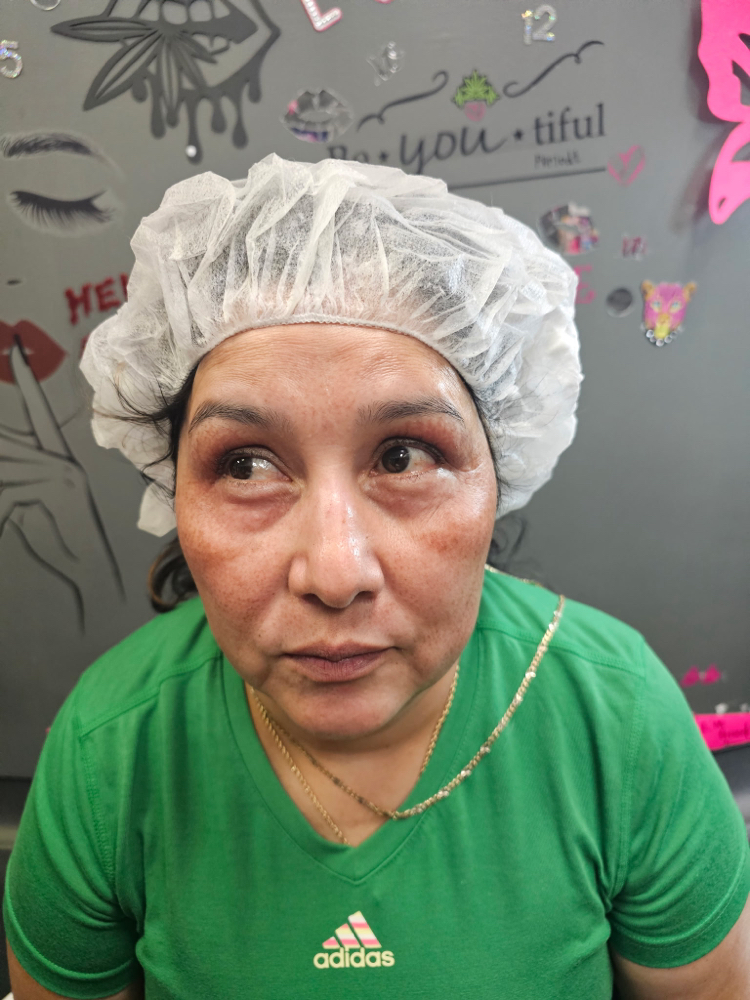 Dermaplaning / Microplaning