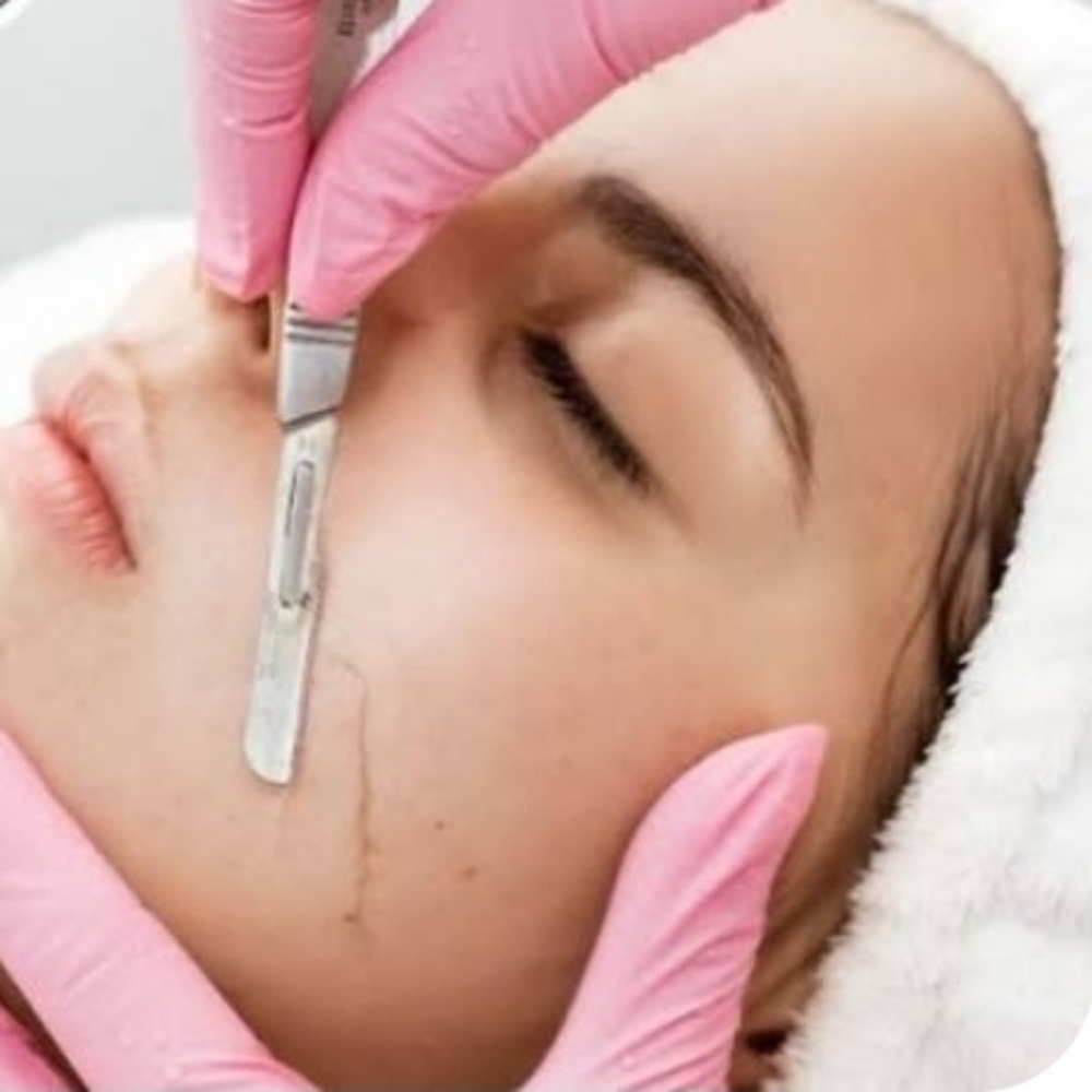 DERMAPLANING ADD-ON at Luna Lash Artistry in Newton Highlands, MA