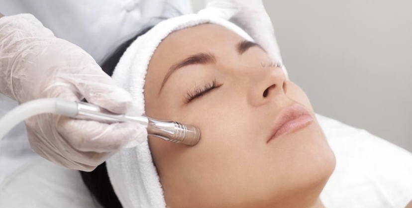 Microdermabrasion