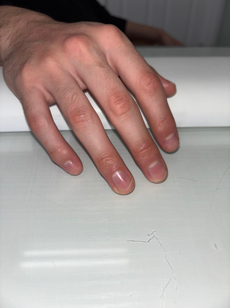 Nail Trim