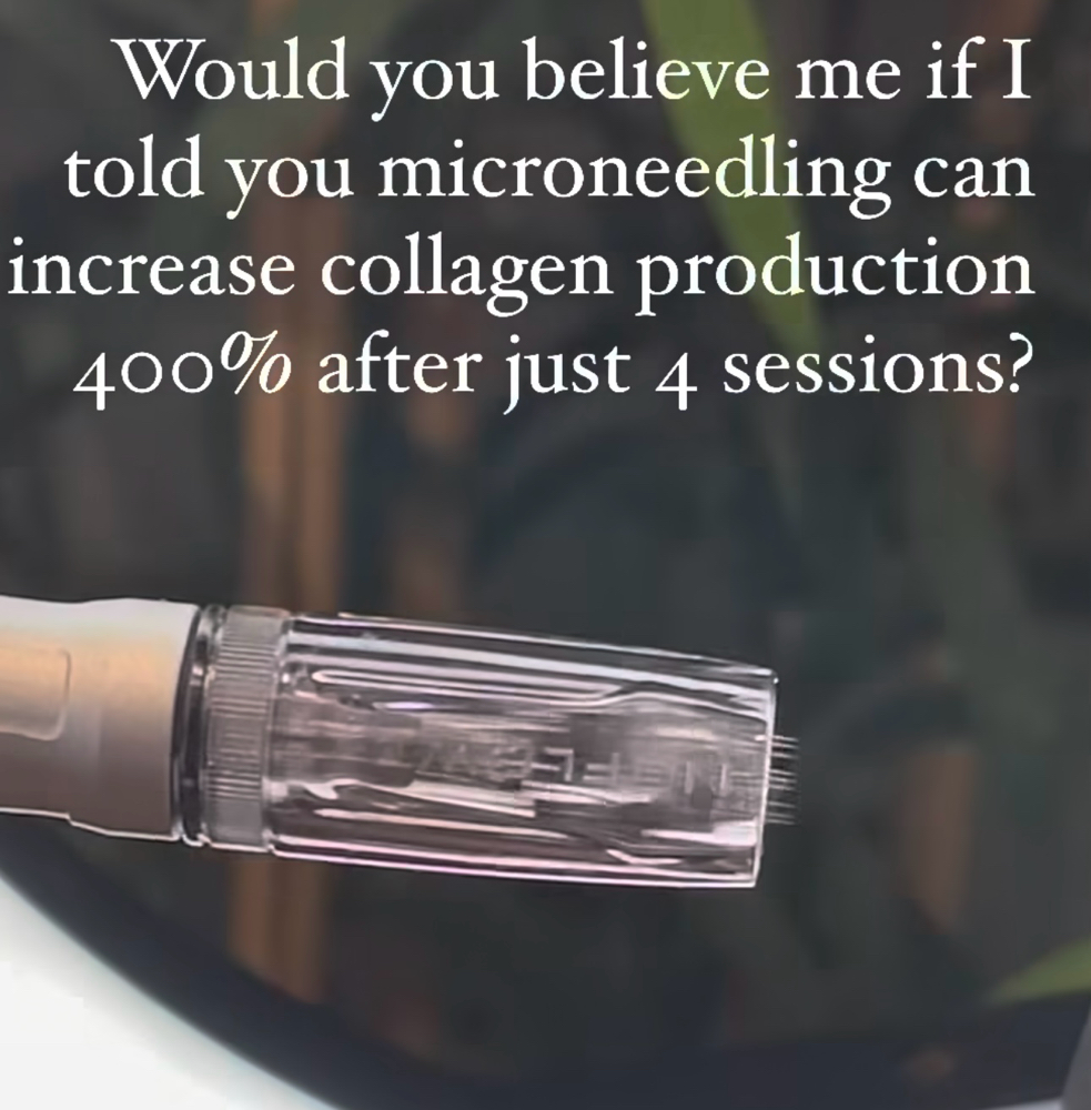 Microneedling Treatments