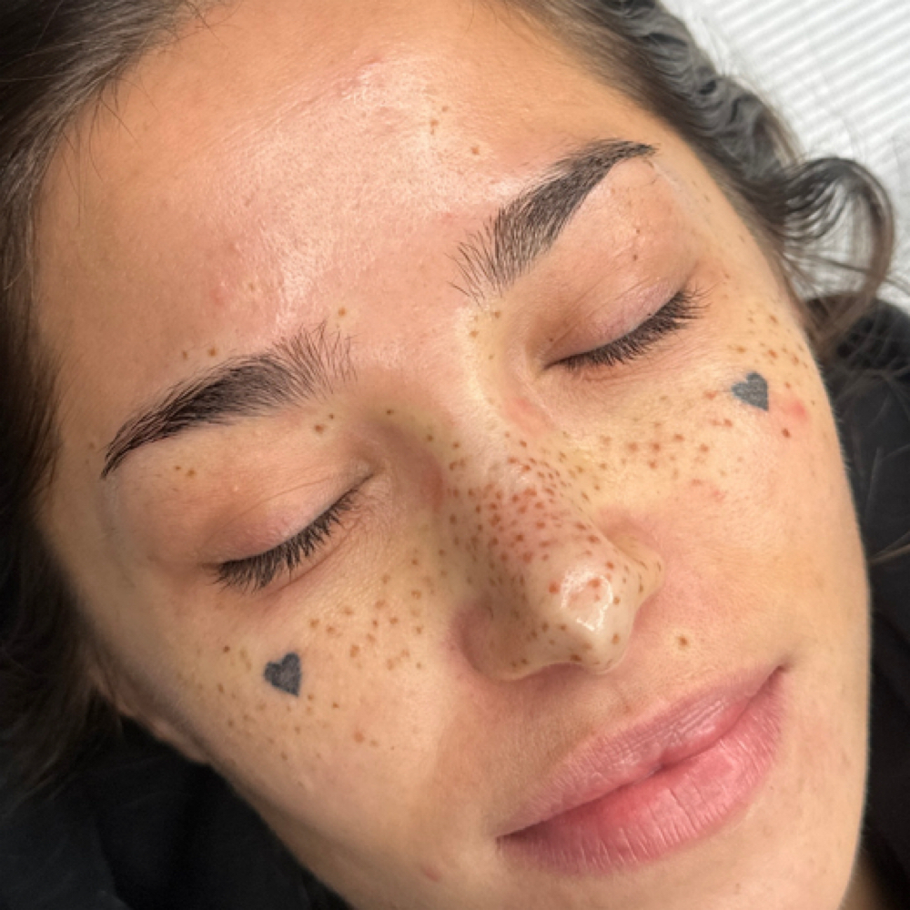 Freckles at Inked by Sam Cosmetic Tattoo in Thousand Oaks, CA
