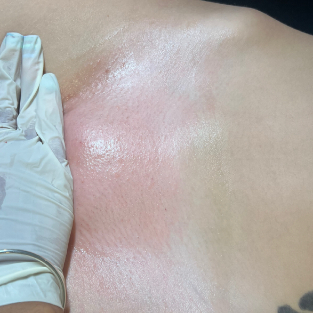 Brazilian Wax at Waxing With Crystal in Roselle, NJ