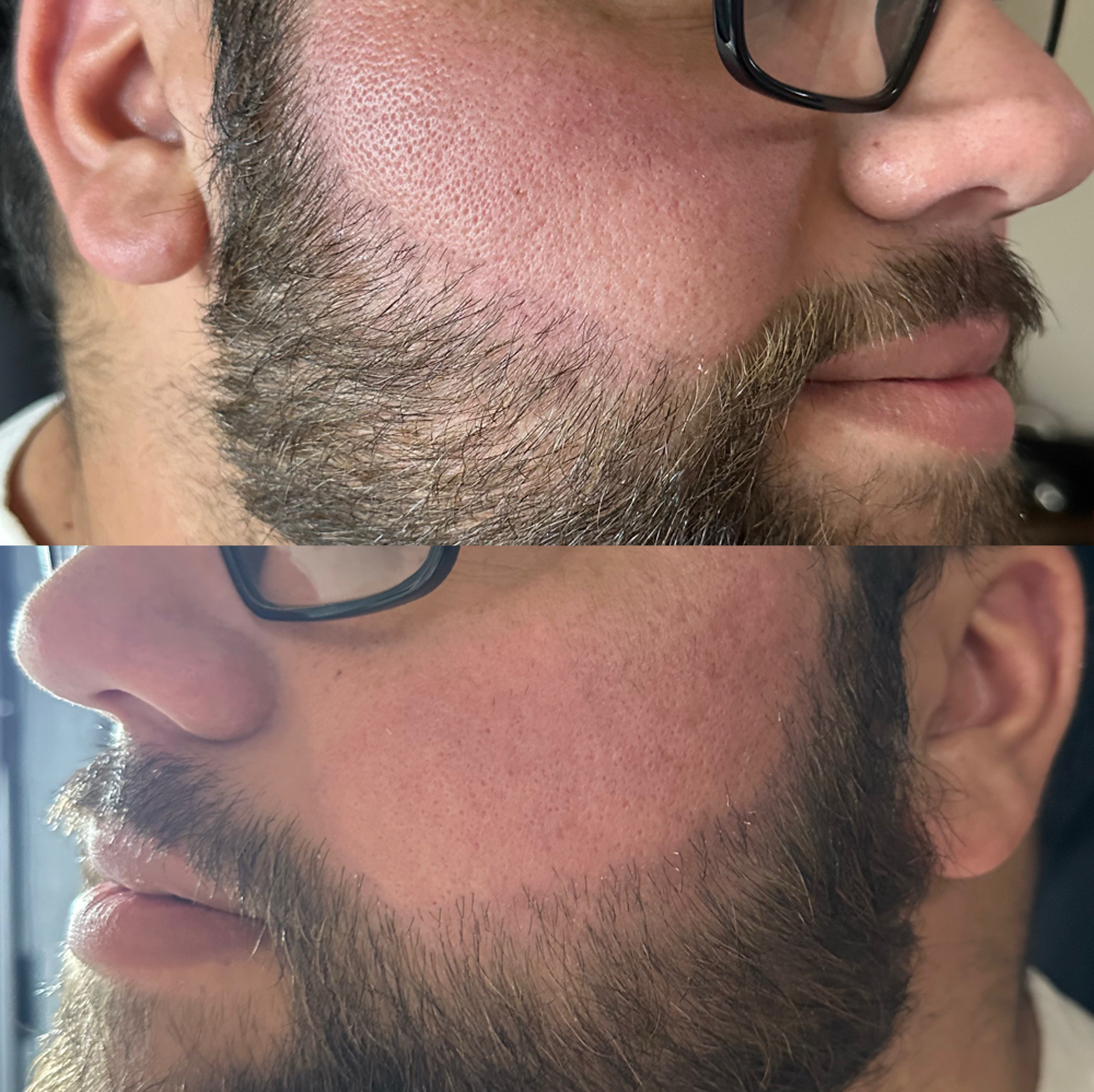 men cheek wax