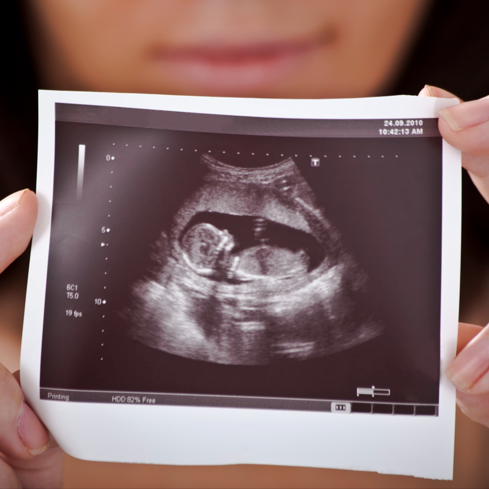 Early Pregnancy Ultrasound at Rancho Cucamonga 3D 4D Ultrasound by 4D Special Delivery in Rancho Cucamonga, CA