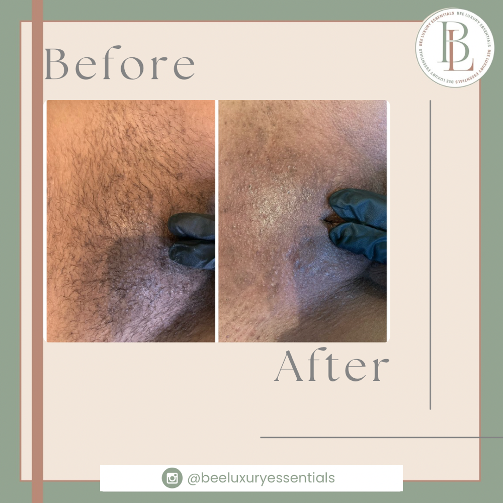 Brazilian Wax