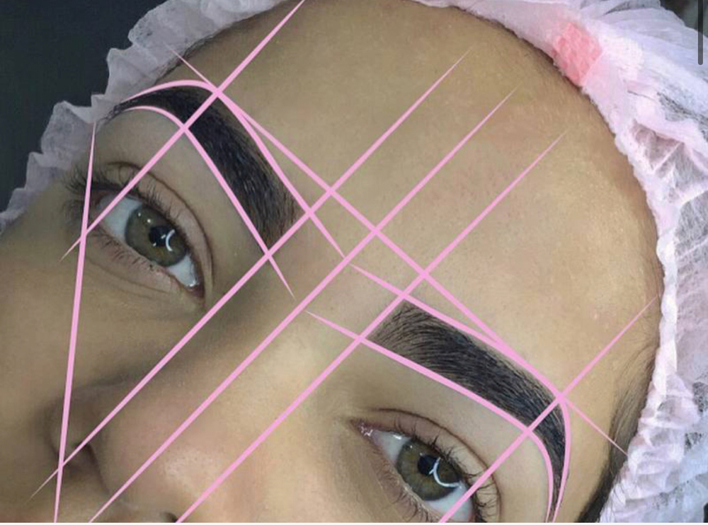 Microshading Consultation
