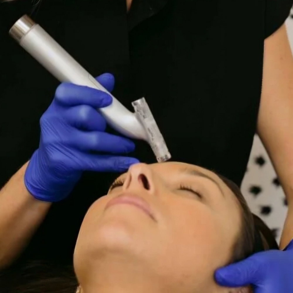 Premium Microneedling- Face+Neck at Aesthetics by Malory in Lubbock, TX