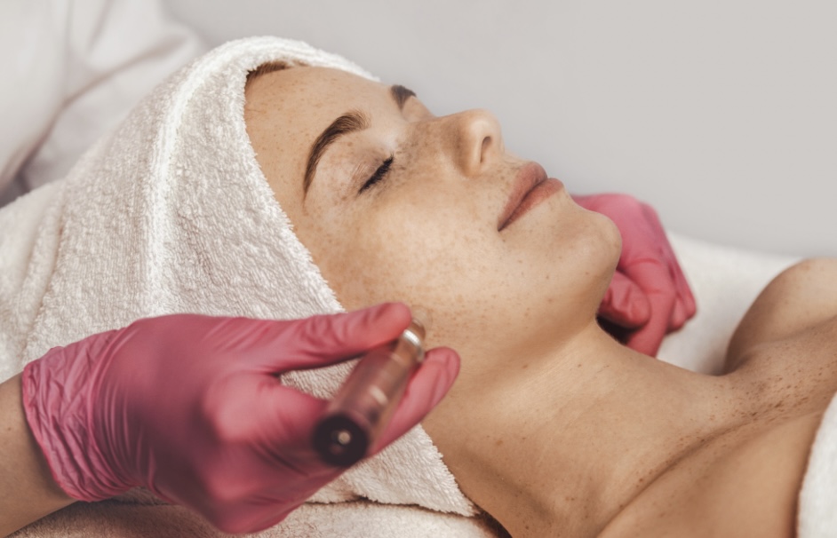 Microdermabrasion