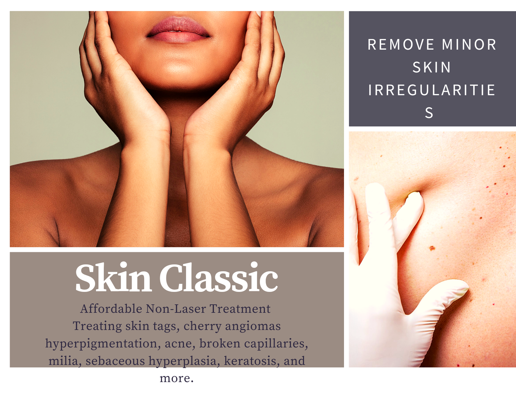 Add Skin Classic Spot Treatment