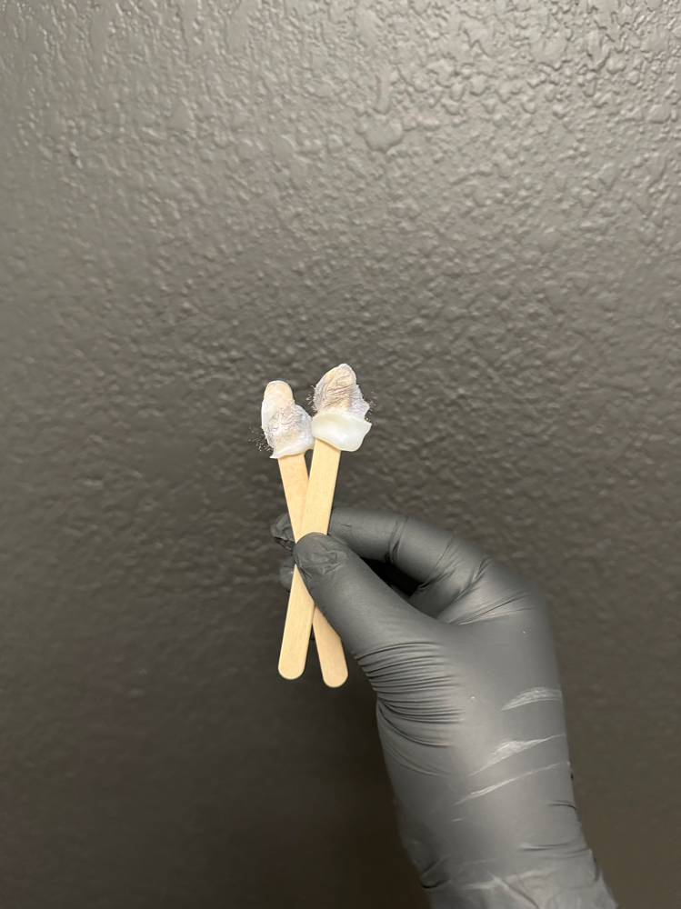 Nose Wax at Chosen Esthetics in Pasadena, TX