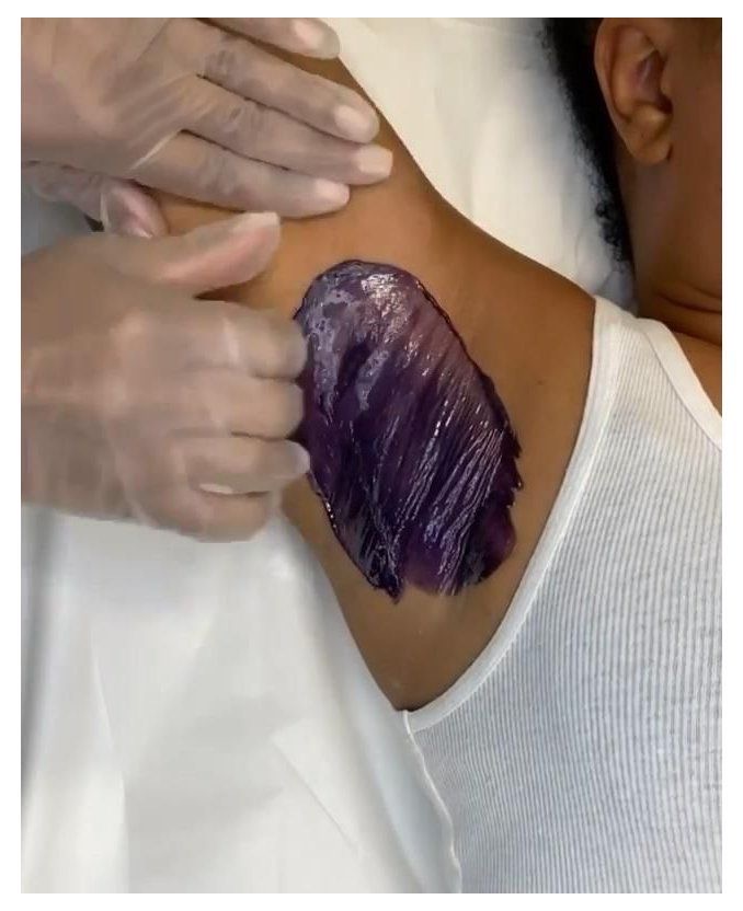 Underarm Wax