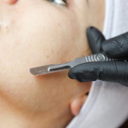 Dermaplaning at GloVolution LLC in Homosassa, FL