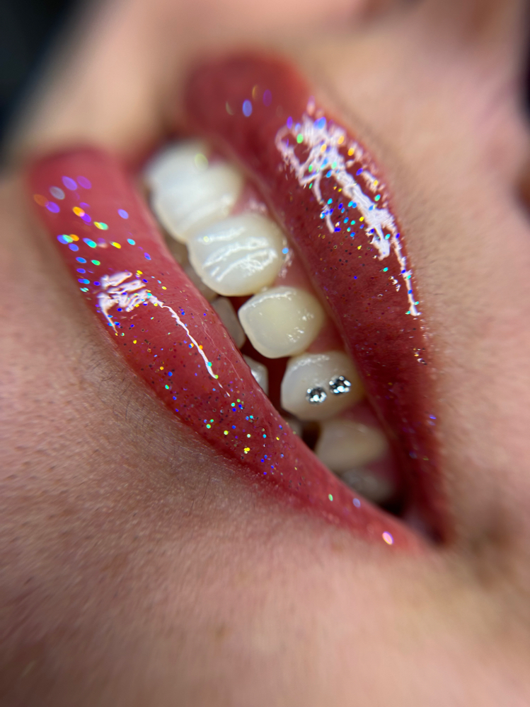 Tooth Gems