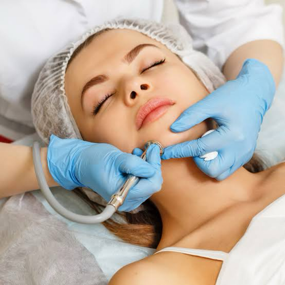 MICRODERMABRASION at Inside Out Beauty Spa By Yas in Grovetown, GA