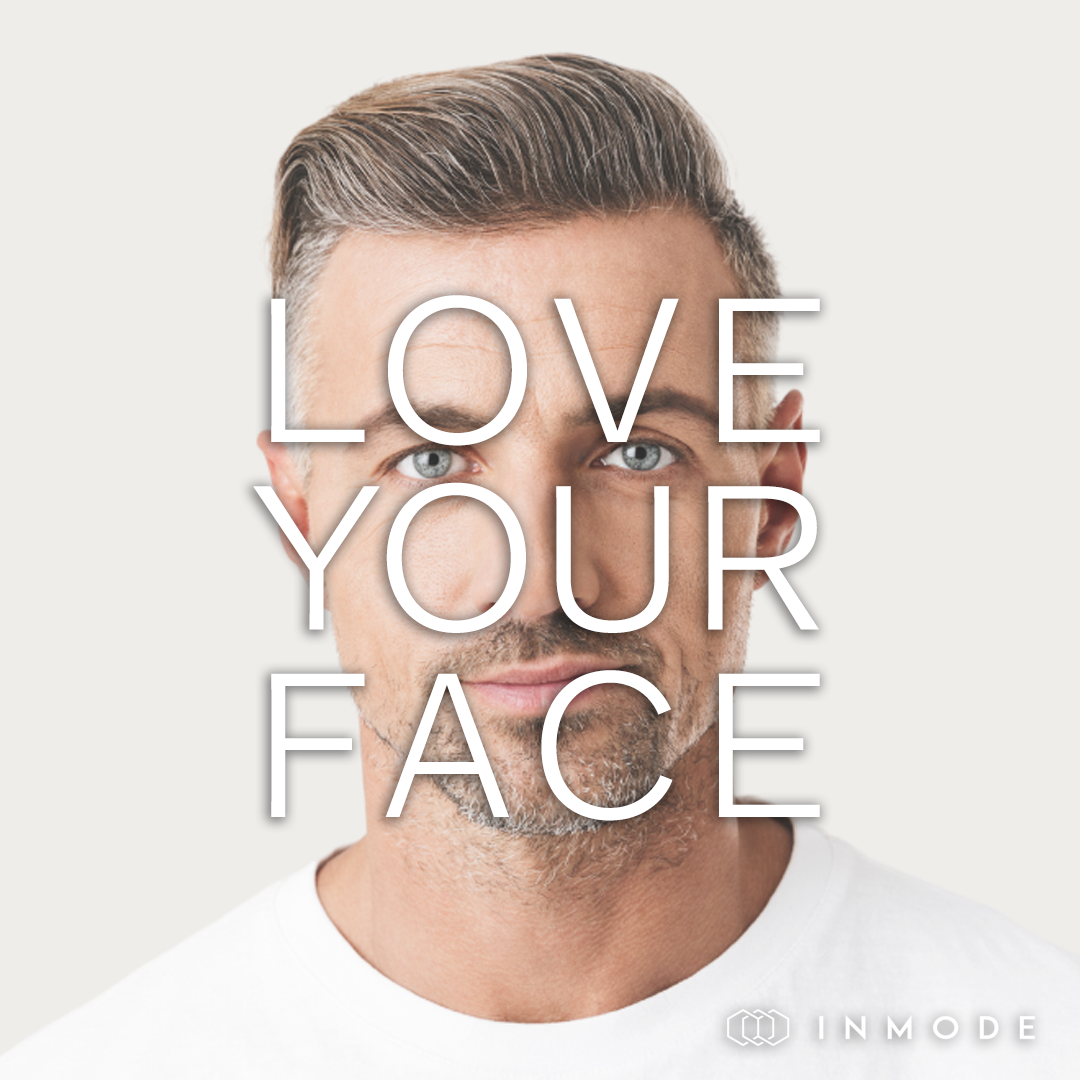 Microneedling for Face