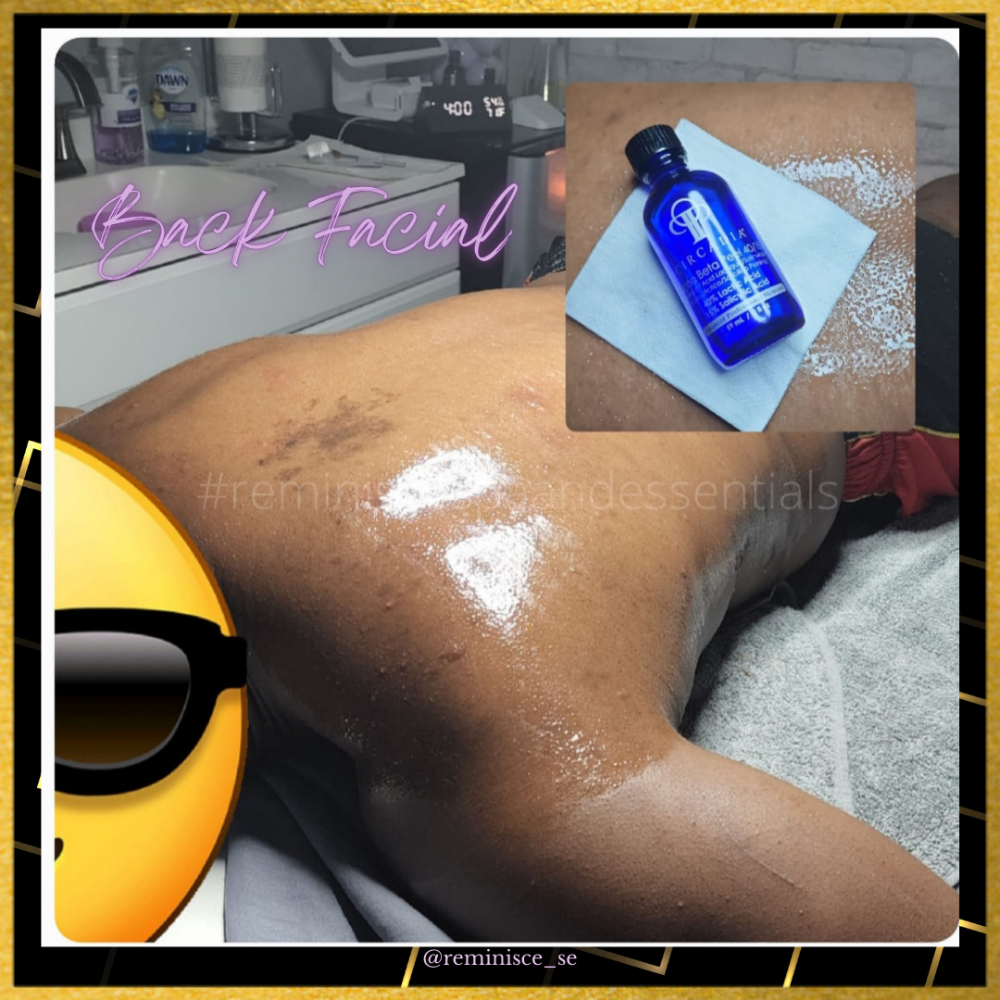 Back Chemical Peel