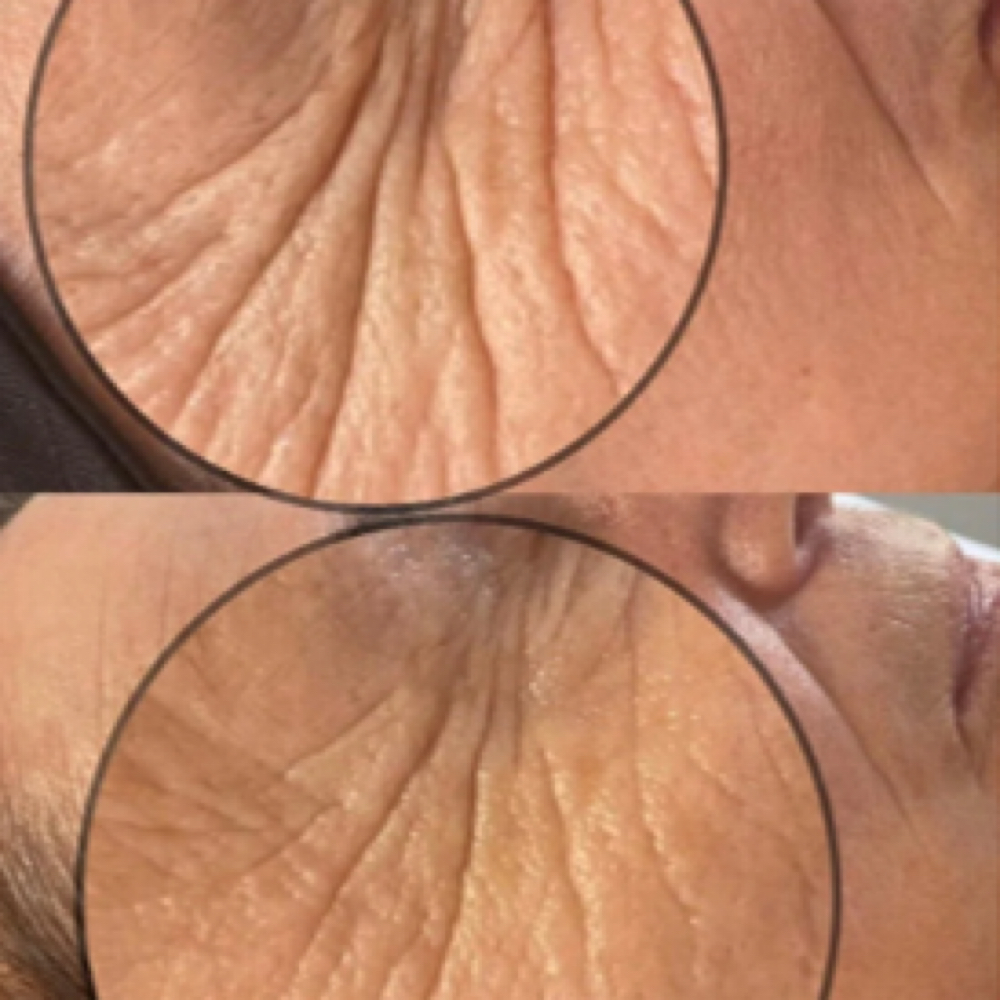 Radiance Renewal Facial at Embrace Skin Studio | Facials in San Francisco's Inner Richmond in San Francisco, CA