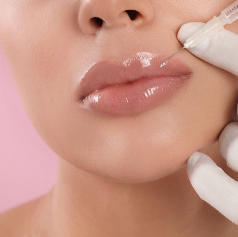Lip Enhancement (Virtual) at THRYV Aesthetics & Wellness in Lutherville-Timonium, MD