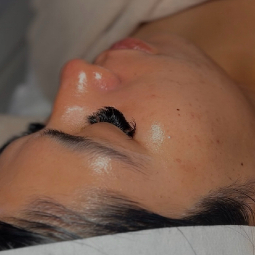 Fresh Start Facial at Sancorsthetics in Riverside, CA