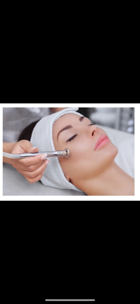Microdermabrasion Facial