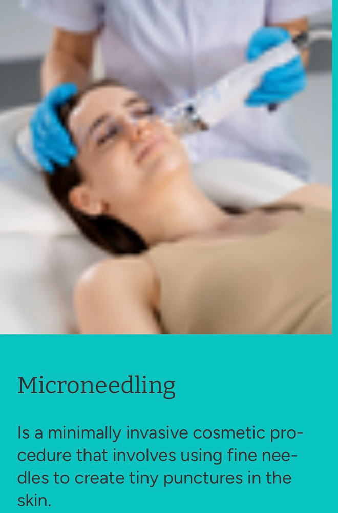 Microneedling Facial