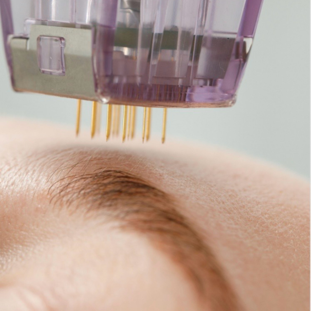 Microneedling Facial at Jubee Boutique MedSpa in Annapolis, MD