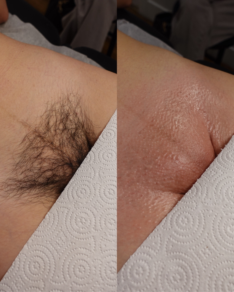 Brazilian Wax
