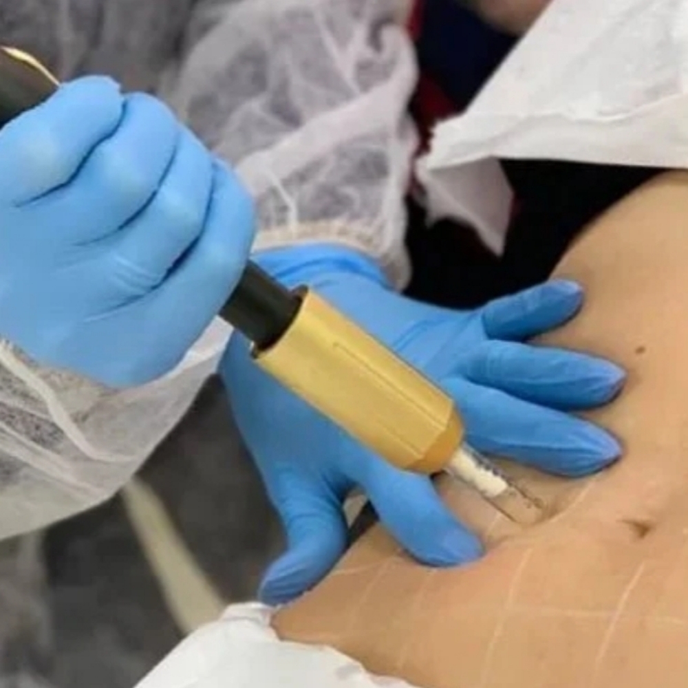 Liquid Lipo Treatment (Love Handles Stomach or Back) 2 Sessions at Le Bar Beaute in Indian Trail, NC