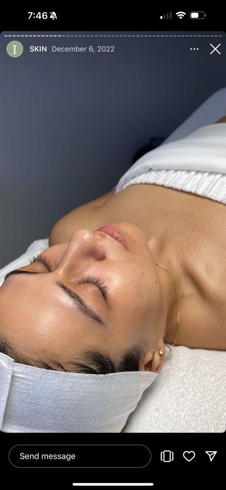 Corrective Custom Chemical Peel at Serene.Esthetics in Franklin Square, NY