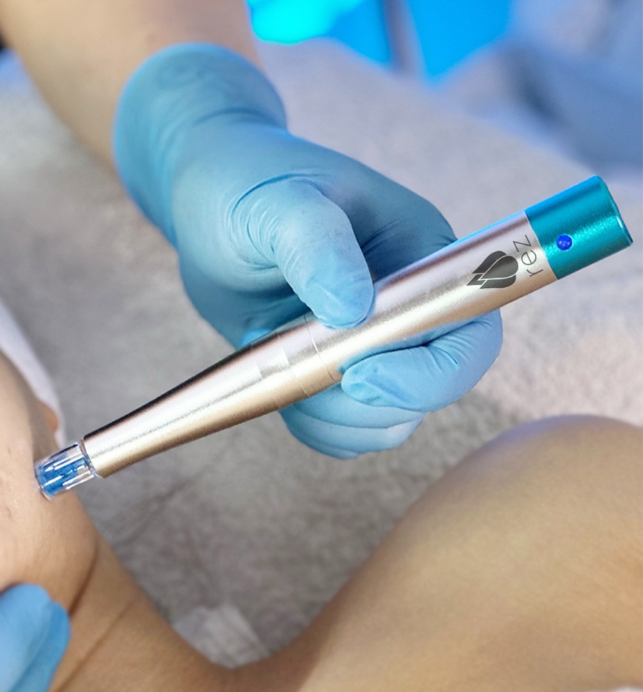 Rezenerate Nano Needling Treatment