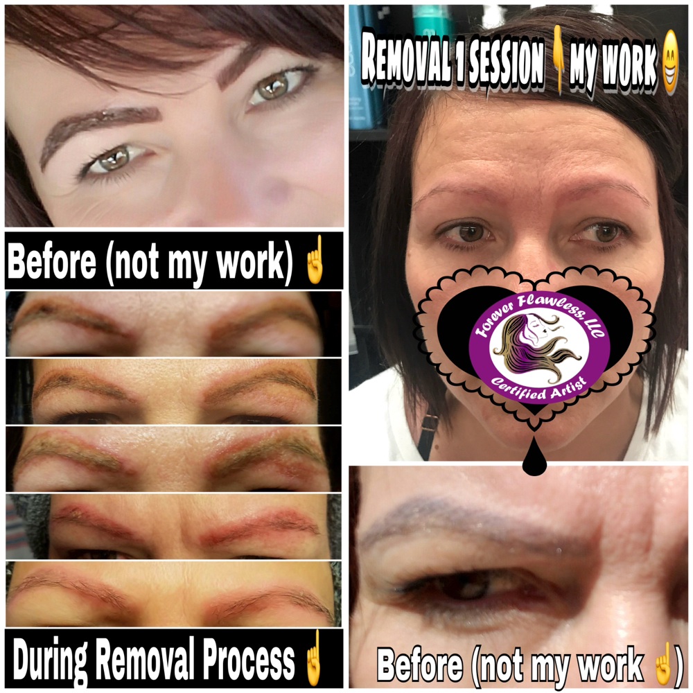 Removal ~ Permanent Cosmetics