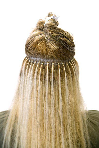 Microlink I-Tips