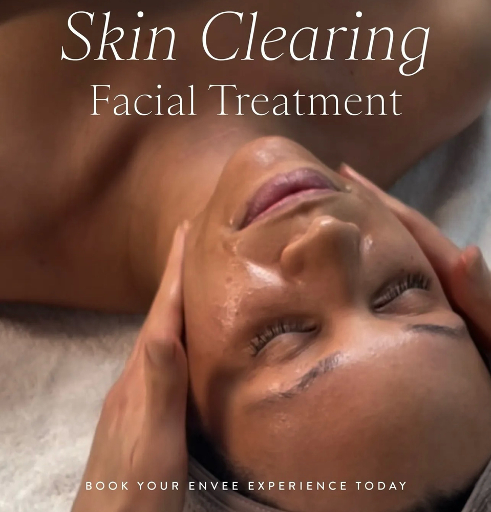 Skin Clearing Acne Facial