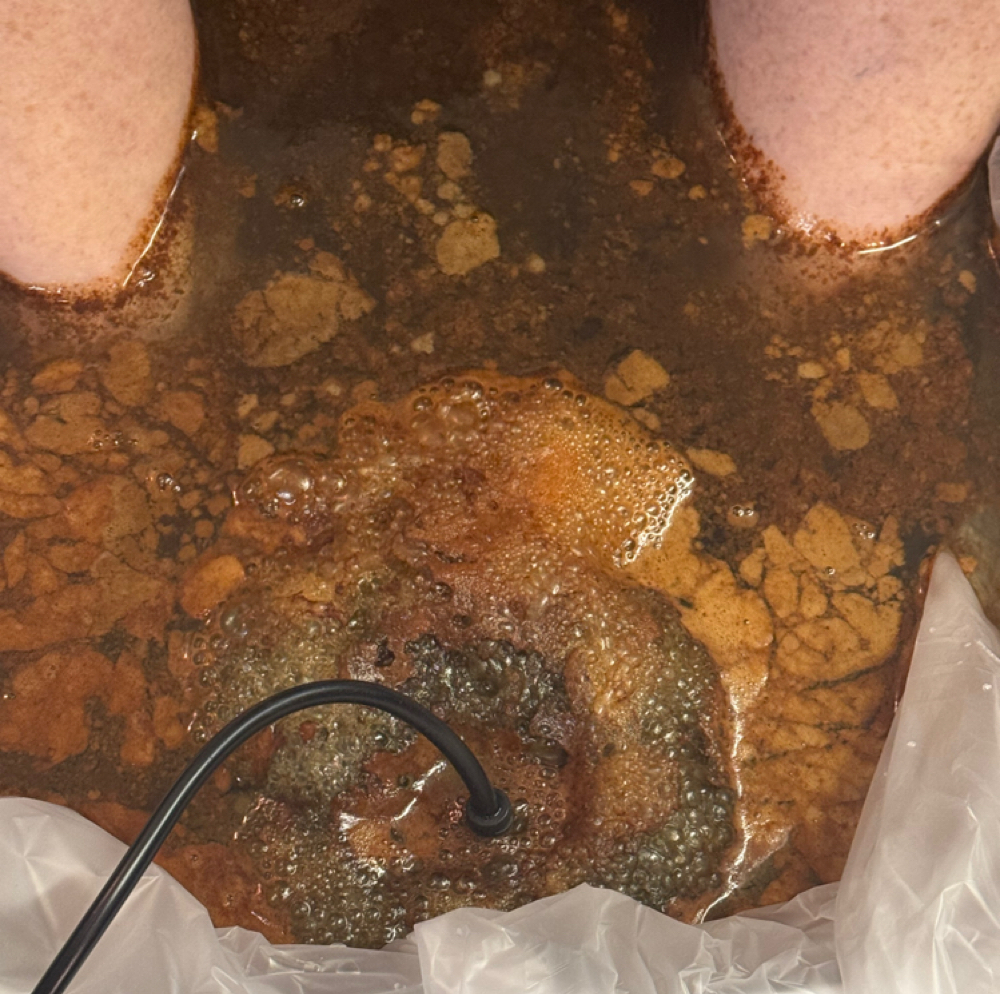 Foot Detox Session at The Body Haven in Wagener, SC