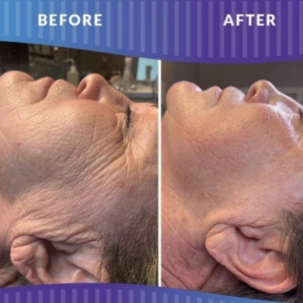 Basic Procell Therapies Facial at Enhanced Beauty Esthetics in Pass Christian, MS
