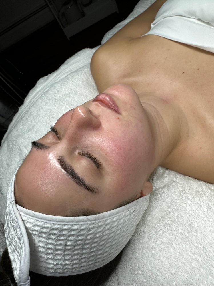 Teen Facial at Skin Remedy in Dartmouth, MA